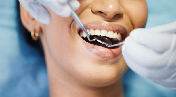 Best Emergency Dental Extractions in Ellisburg, NJ